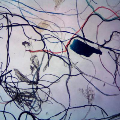 Vue microscopique de microplastiques retrouvés dans la rivière des Outaouais